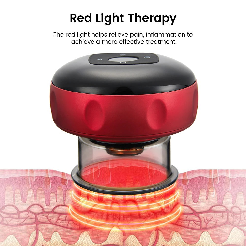 CupPulse™ Electric Cupping Massager