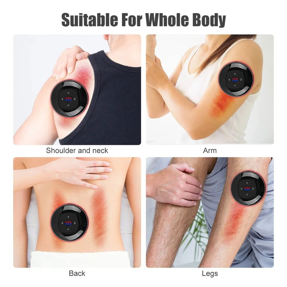 CupPulse™ Electric Cupping Massager